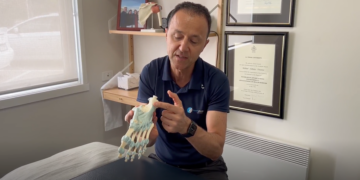 plantar fasciitis